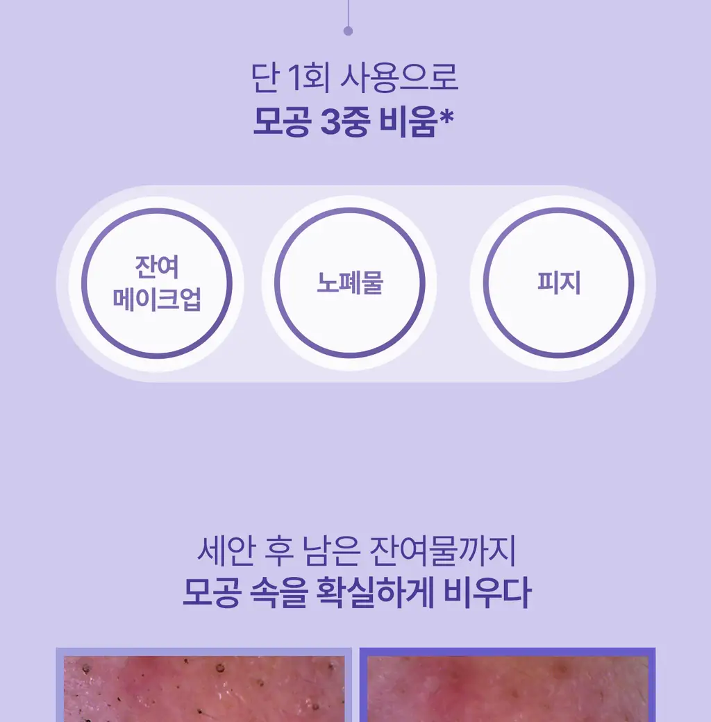 [5월 올영픽/126매 대용량/올리브영 단독] 리쥬란 포어 타이트닝 토너 패드 60매 더블 한정 기획 상세페이지 21